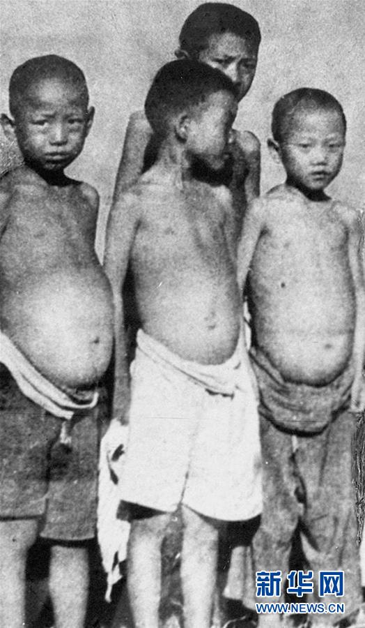 （紅土地&ldquo;往事新說&rdquo;&middot;圖文互動）（6）昔日送&ldquo;瘟神&rdquo;  今朝健康促小康